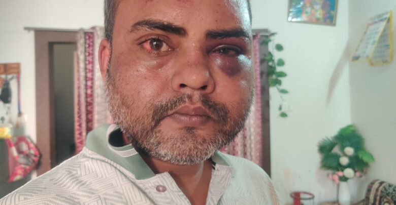 रायपुर में गुंडागर्दी का तांडव: सॉफ्टवेयर इंजीनियर की बेरहमी से मारपीट, वीडियो वायरल