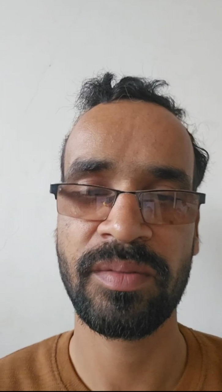 सीएम हेल्पलाइन 1076 ईवी सब्सिडी छत्तीसगढ़